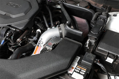 K&N Engineering 69-5321TS Cold Air Intake System for 2015 Hyundai Sonata and Kia Optima