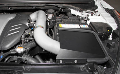 K&N Engineering 69-5312TS Cold Air Intake System for Hyundai Veloster Turbo 1.6L